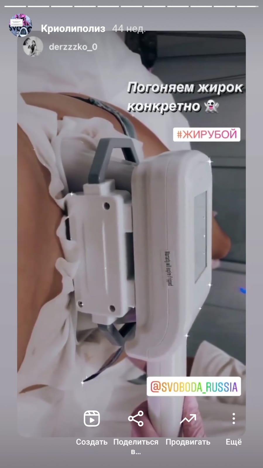 отзыв криолиполиз 5